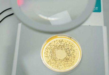 IUL COLONY COUNTER kézi telepszámláló